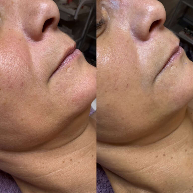 01B211A5-4135-48E2-A67B-E2EA6C403A34