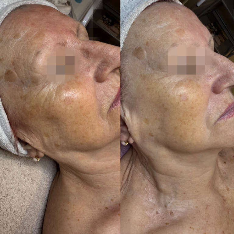 3820815F-17B4-4A0F-A3B0-CA88142C6E64