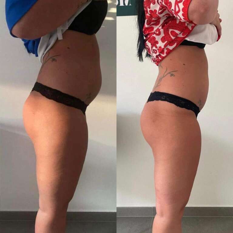 HIEMT-Elotte-Utana-3-1024x1024