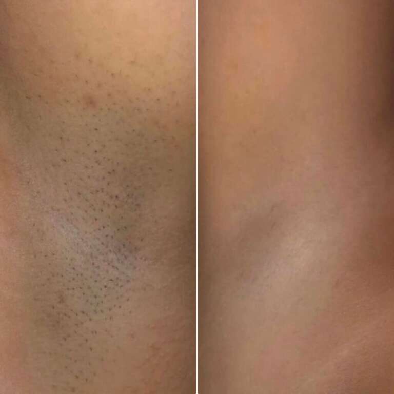 xr:d:DAF0zK1uyrE:11,j:3554875907662779746,t:23112113